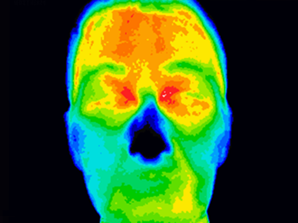 Thermal image